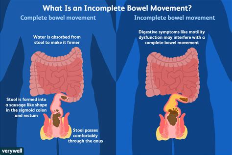 promote bowel movement peristalsis